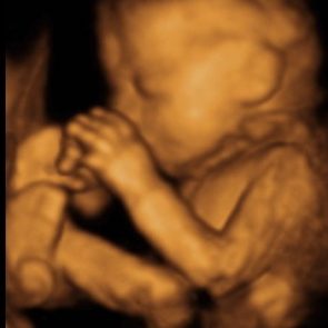 3d-ultrasound-23-weeks-4-days-whole-body